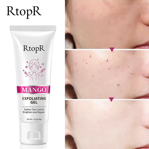 Facial Exfoliating Gel Skin Care Whitening Moisturizing Repair Facial Scrub Cleanser Cleansing Acne Blackhead Cream Face Care